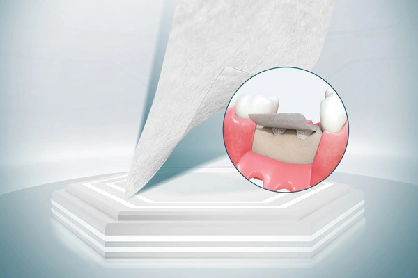 วัสดุศัลยกรรมฟัน