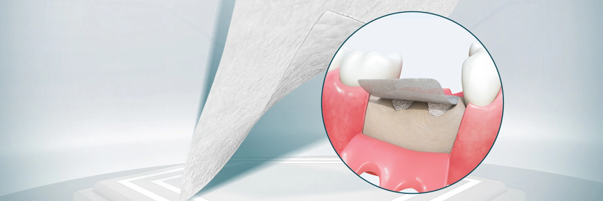 วัสดุศัลยกรรมฟัน