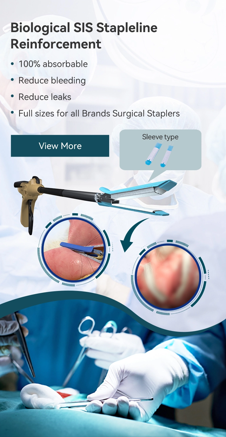 การเสริมแรงลวดเย็บกระดาษชีวภาพ