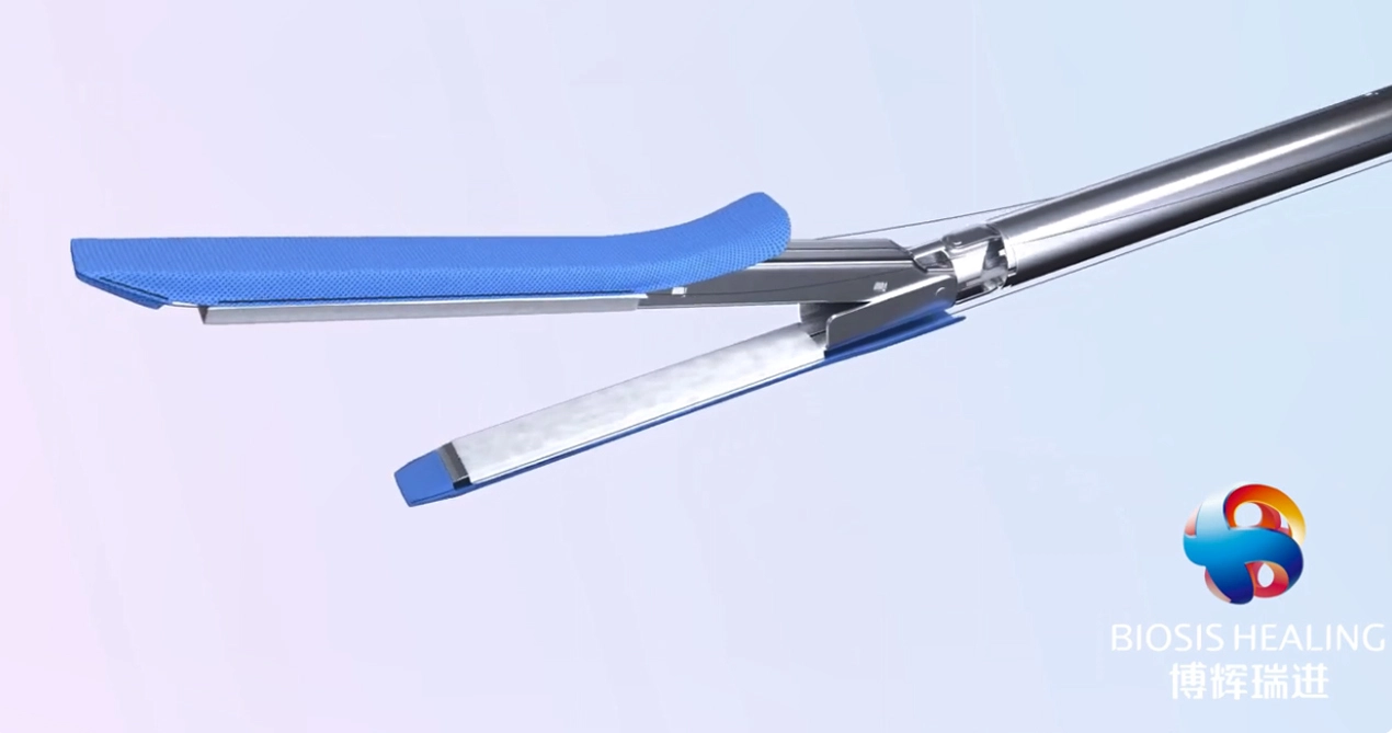 Staple line Reinforcement for Sleeve gastrectomy for bariatric surgery