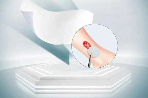 ผลิตภัณฑ์จัดการบาดแผล