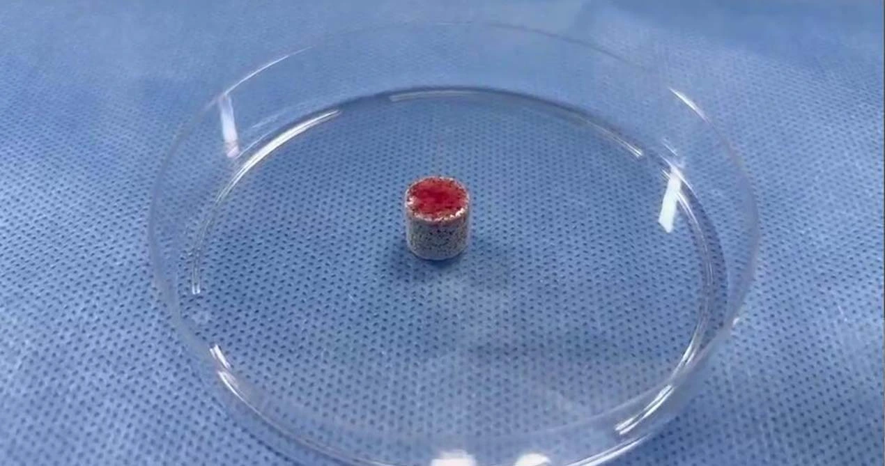 วัสดุการปลูกถ่ายอวัยวะกระดูก