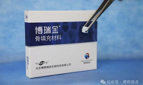 ผลิตภัณฑ์วัสดุ graft กระดูก vidasis ได้รับการรับรองอย่างเป็นทางการและ biosis Healing Oral Family ยินดีอีก