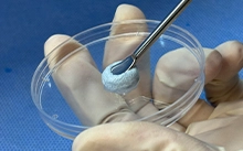 วัสดุการปลูกถ่ายอวัยวะกระดูก